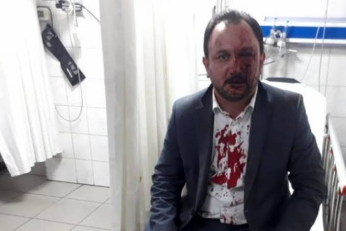 Dayağın Perde Arkasında Ne Var?