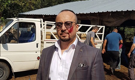 İcra Takibi Sırasında Avukata Bıçaklı Saldırı!