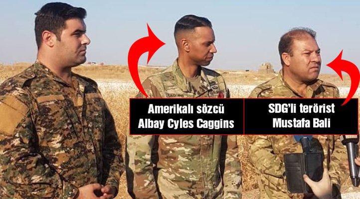 ABD Kaşınıyor!!!