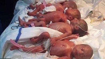 Malili kadın 9 çocuk doğurdu: 5’i kız 4’ü erkek