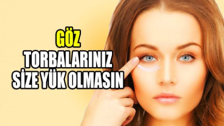 Göz torbalarınız size yük olmasın!