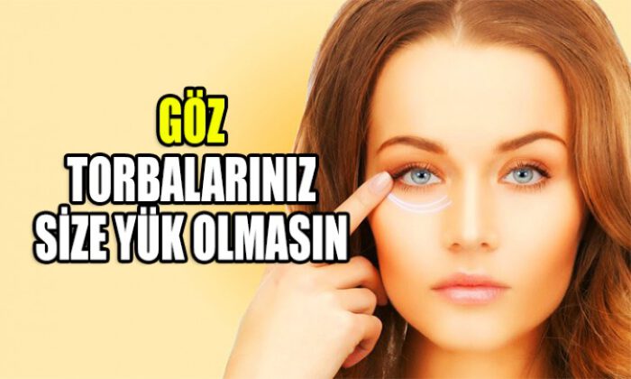 Göz torbalarınız  size yük olmasın!