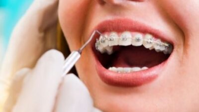 “Ortodonti Tedavisi Her Yaşta Uygulanabilir”