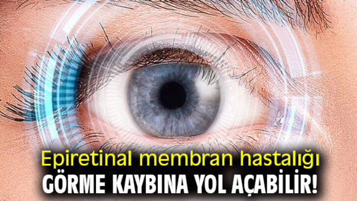 Epiretinal membran hastalığı görme kaybına yol açabilir!