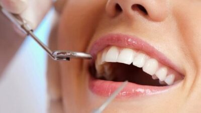 Sağlıksız ve düzensiz beslenme dişlerde sararmaya yol açıyor