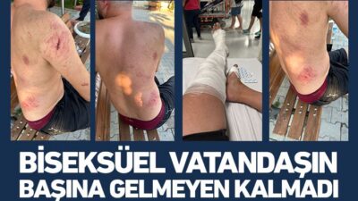 Biseksüel tercihi yüzünden işyeri Basıldı, Öldüresiye Dövüldü!