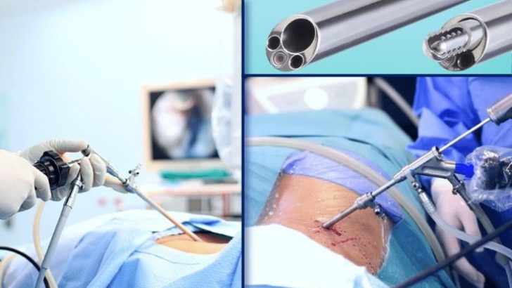 Kapalı Bel Fıtığı Ameliyatı, Hastalara Avantaj Sağlıyor