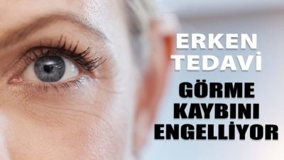 Glokomda Erken Tedavi Görme Kaybını Engelliyor