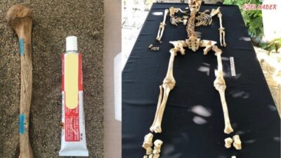 Parionluların muzdarip olduğu hastalıklar