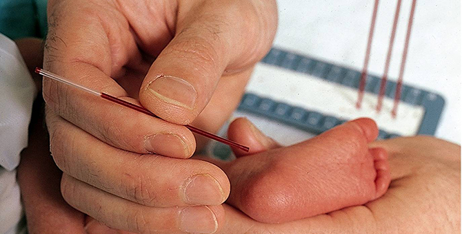 Topuk Kanı Uygulaması: Sağlık Taraması mı, Genetik Veri Toplama Operasyonu mu?