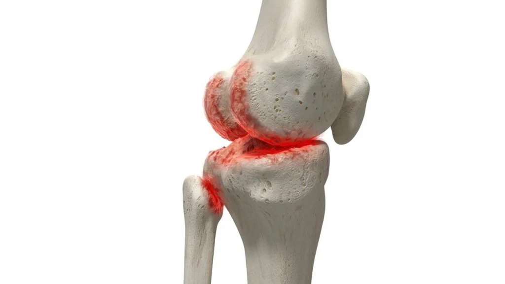 Alman Araştırmacılardan Kıkırdak Yenilenmesinde Çığır Açan Jel